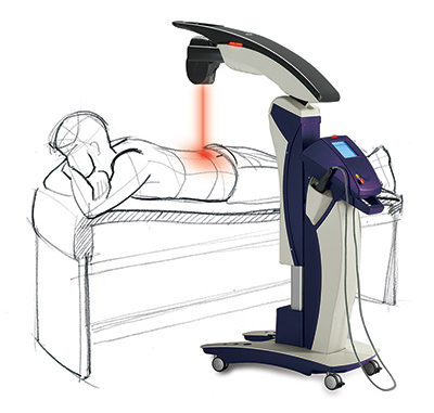 MLS Laser Therapy {{brizy_dc_image_alt imageSrc=